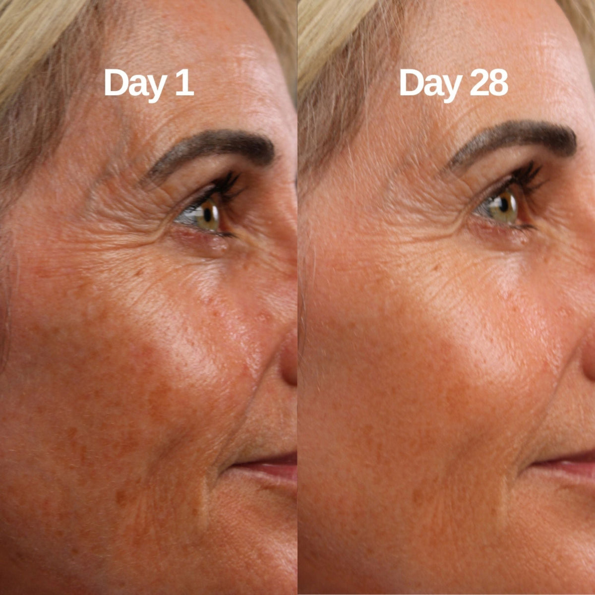 Before and after comparison of a woman's face showing skin improvement over 28 days. Best collagen mask